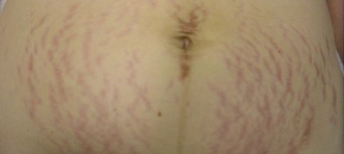 IMG_1951